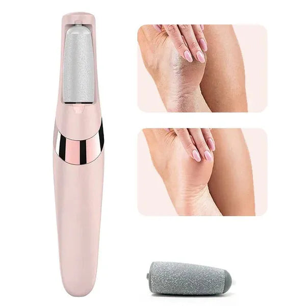 Electric Pedicure Foot File & Callus Remover – Rechargeable Foot Care Device for Smooth, Soft Heels